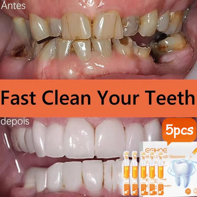 Teeth Whitening Baking Soda - Schnell reparierendes Zahnfleischserum, lindert Nachwachsen von