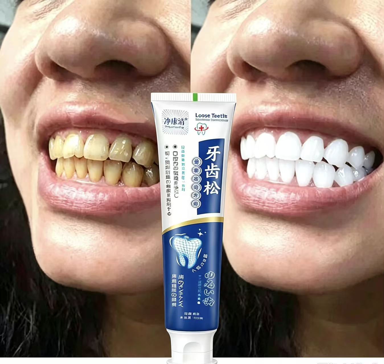 Teeth Whitening Fast - Zahnaufhellungs-Pflegetropfen: Schnelle Reinigung von gelben Zähnen,