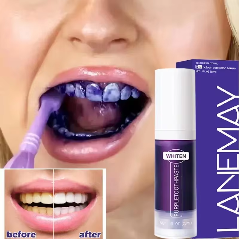 Teeth Whitening Crest - V34 Lila Zähne Bleaching Zahnpasta Entfernen