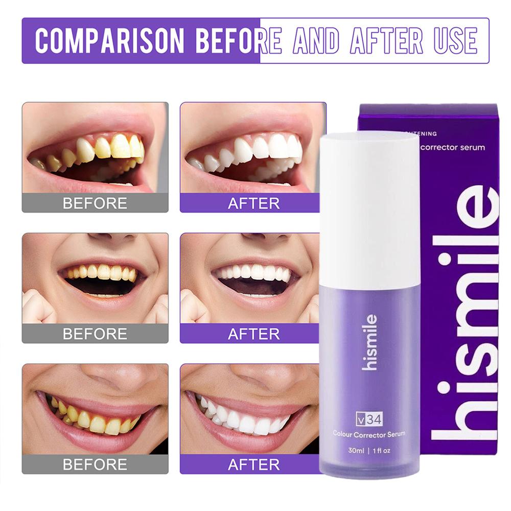 Teeth Whitening Cream - Lila Zahnaufhellungsstreifen Bleichende Fleckenentferner Mundpflege-Zubehör Zahnaufhellungs-Aufkleber