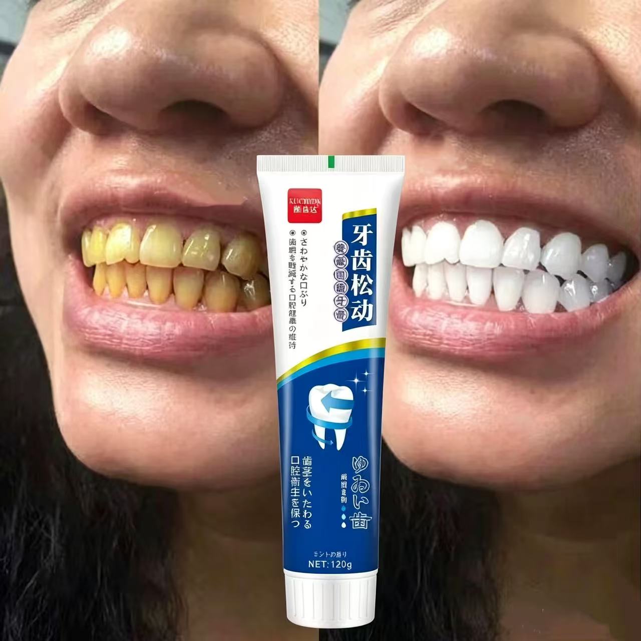 Japanische Import-Zahnpasta ge – Teeth Whitening Japanese Bewertung und Preis