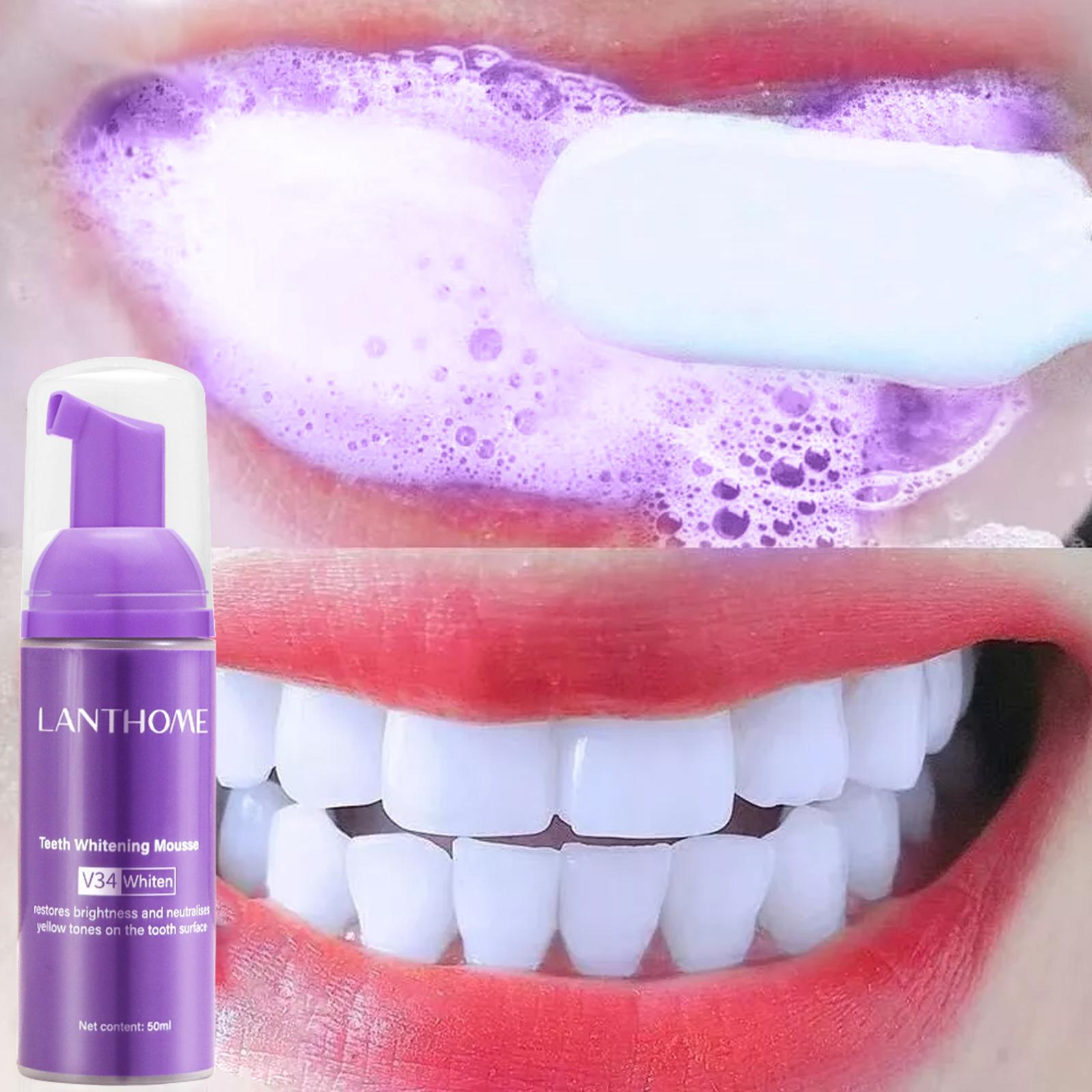 V34 Mousse Zahnreinigungs-Zahn – Teeth Whitening Crest Bewertung und Preis