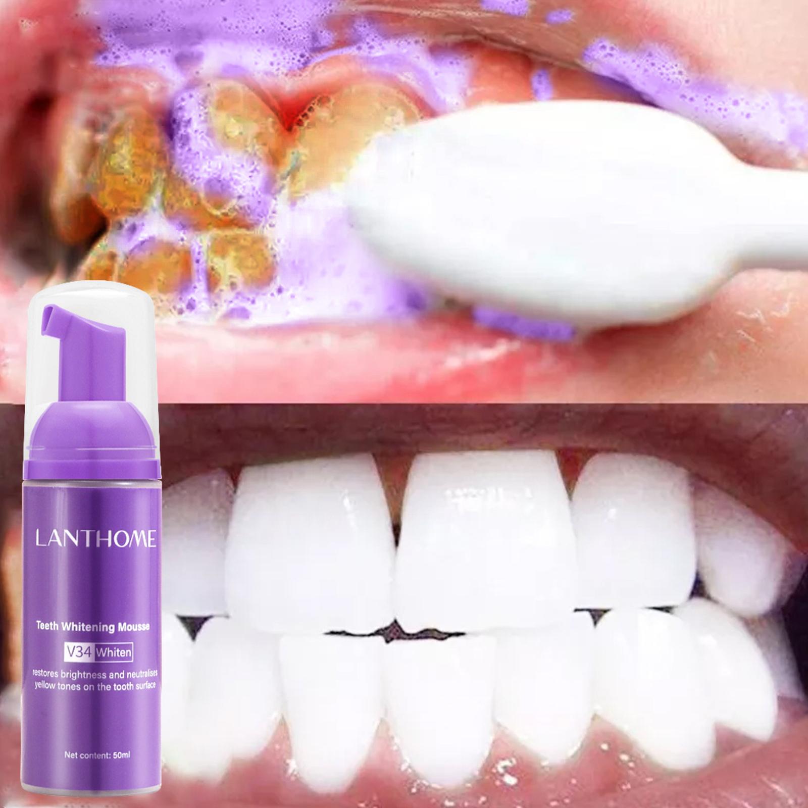 V34 Mousse Zahnreinigungs-Zahn – Teeth Whitening Crest Bewertung und Preis