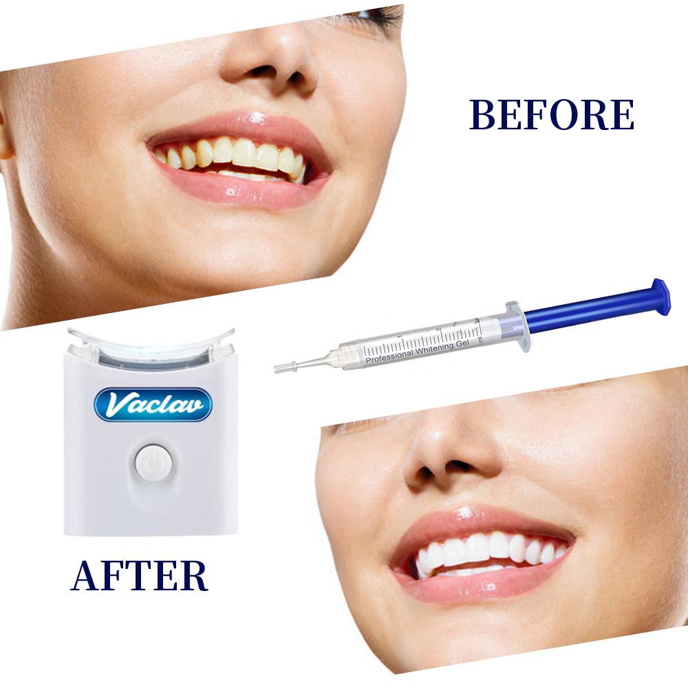 Minze Zähne Bleaching Gel Spri – Teeth Whitening Baking Soda Bewertung und Preis