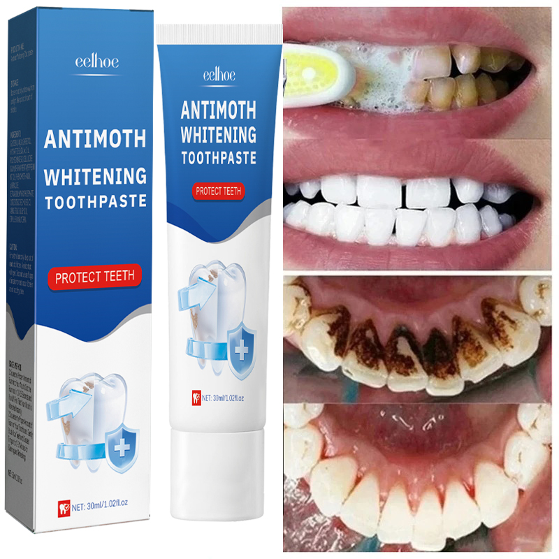 Schnelle Entfernung von Rauchf – Teeth Whitening Fast Bewertung und Preis