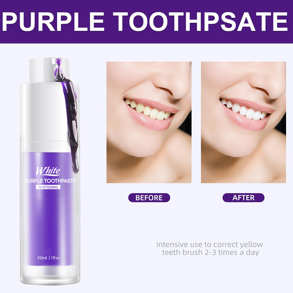 Lila Zahnaufhellungs-Zahnpasta – Teeth Whitening Cream Bewertung und Preis