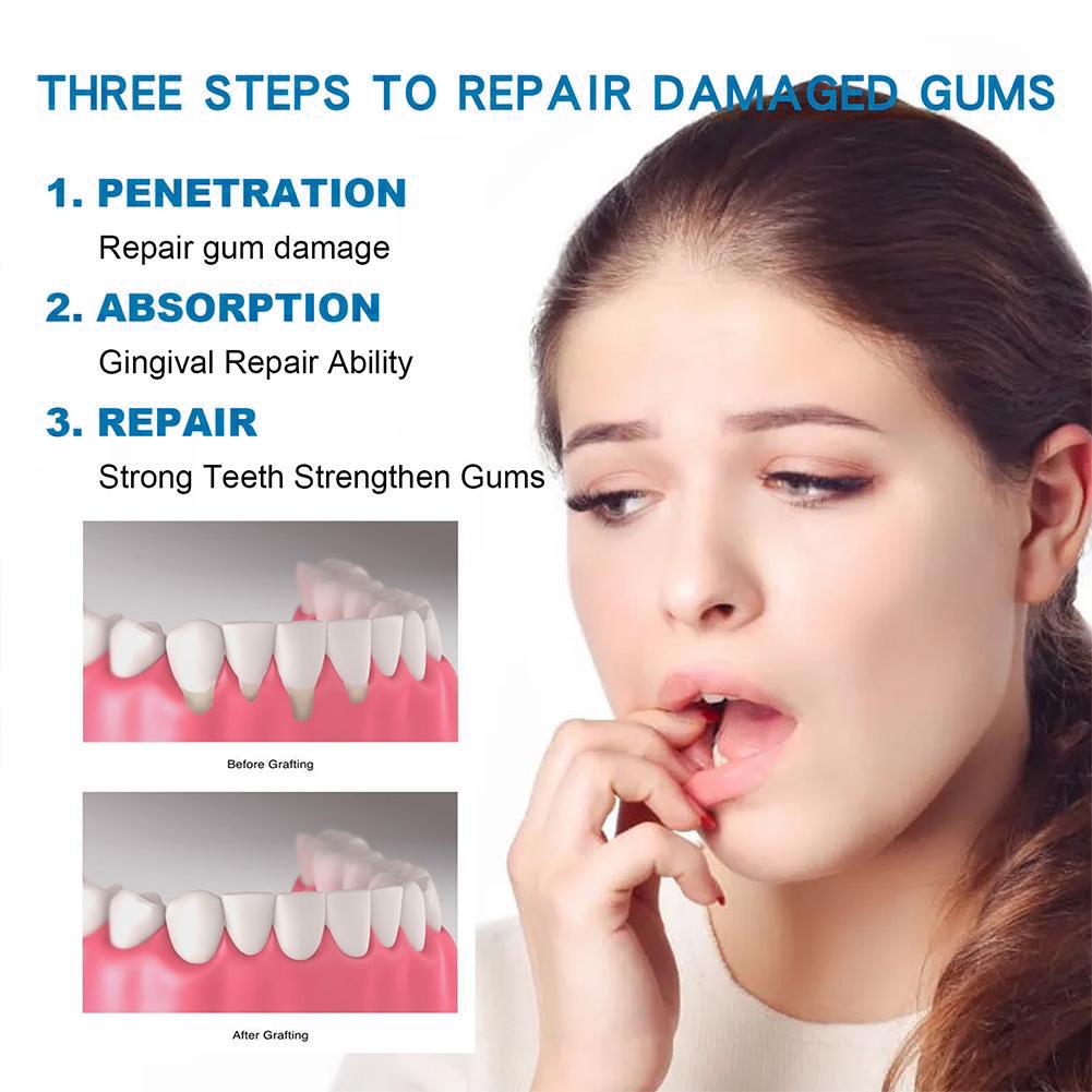 Zahnpasta für die Zahnpflege,  – Teeth Whitening Cream Bewertung und Preis