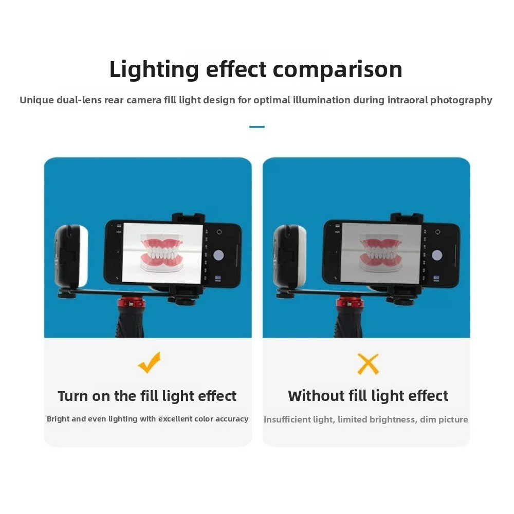 Licht für zahnärztliche Fotogr – Teeth Whitening Kit Bewertung und Preis