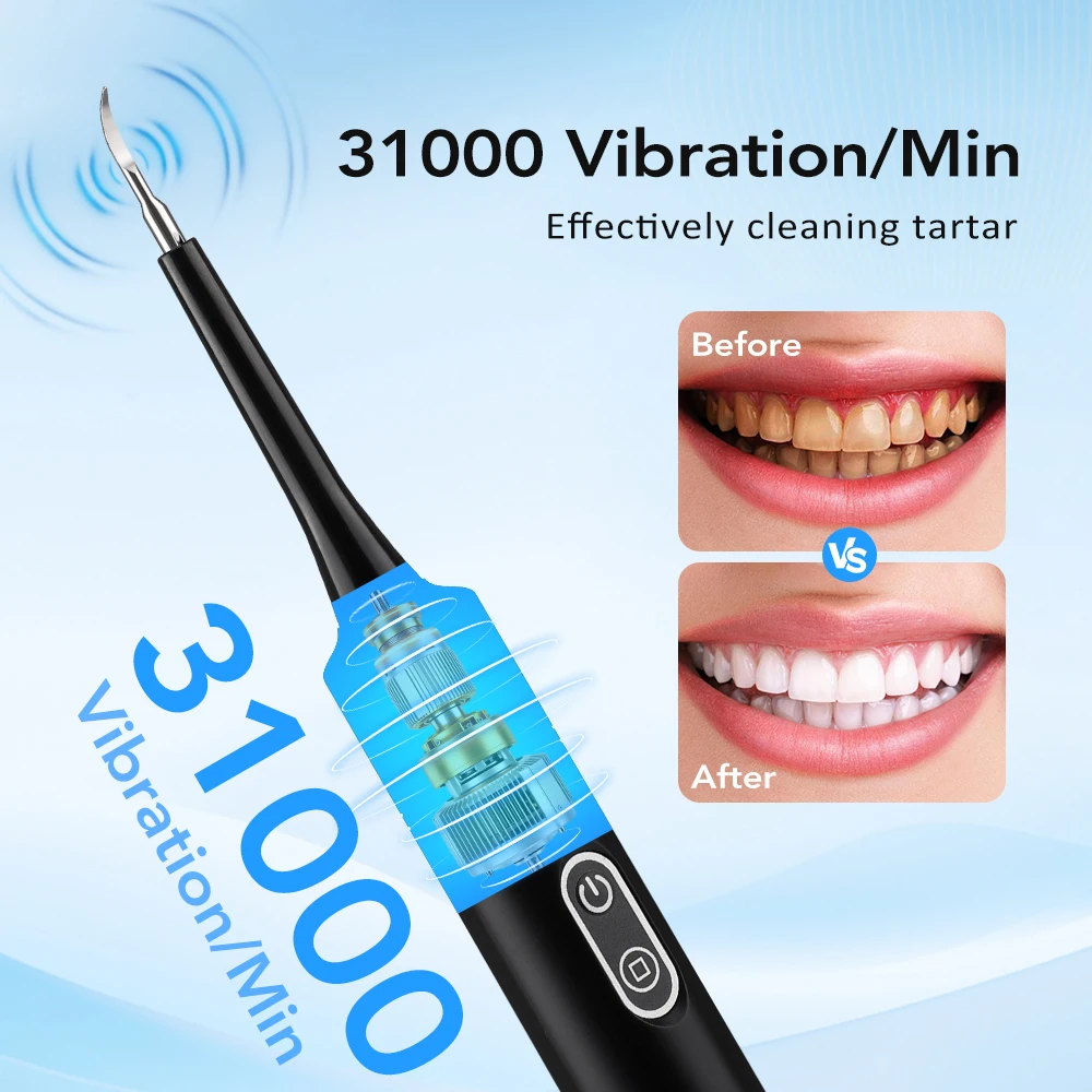 Elektrischer Schallvibrations- – Teeth Whitening Express Bewertung und Preis